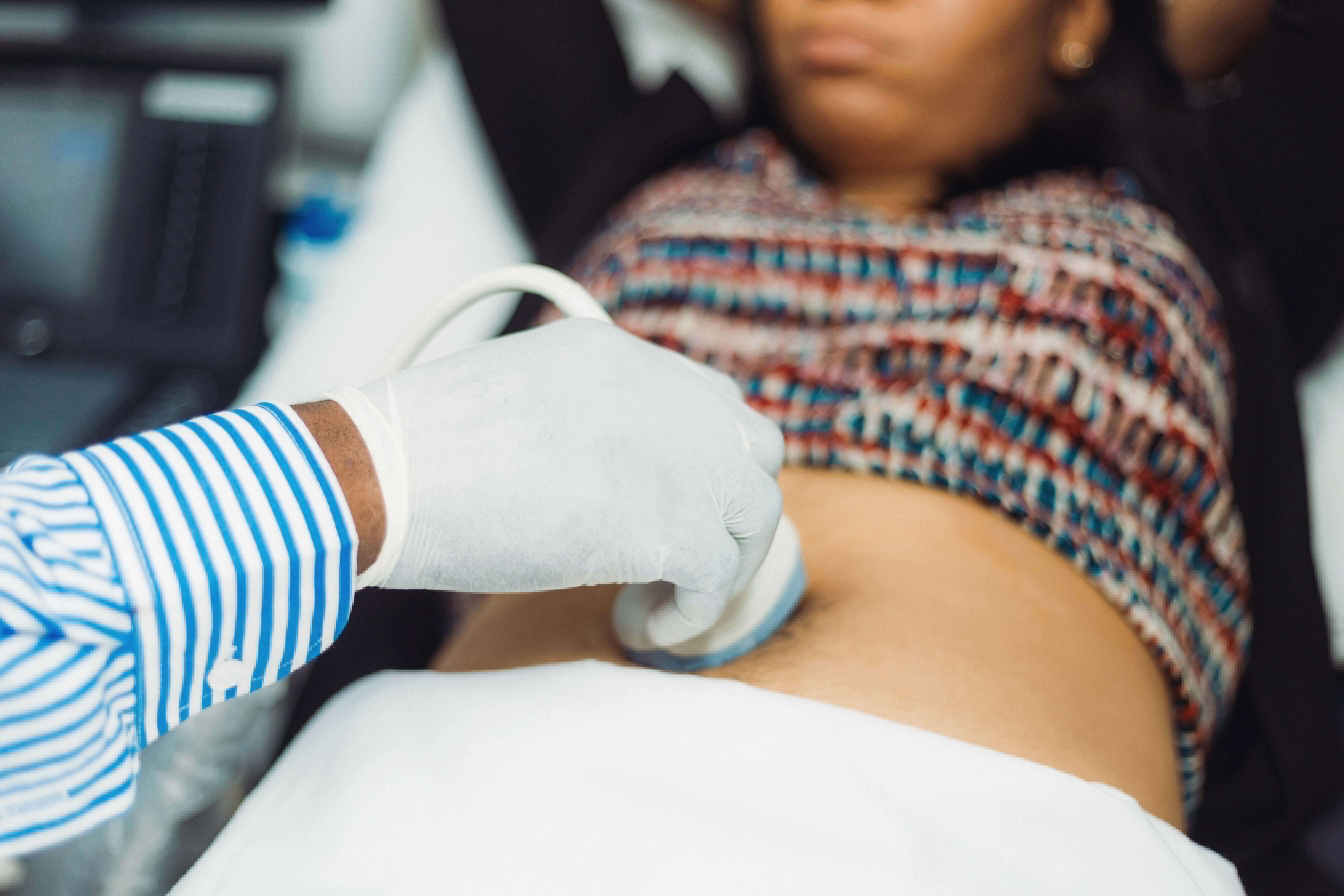  Ultrasound Scan machine